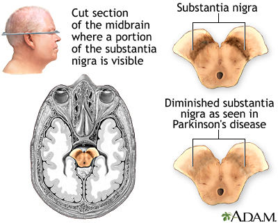 Substantia nigra and Parkinson's disease